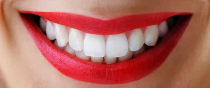 Avoir des dents saines sans se ruiner !