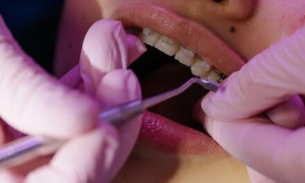 Orthodontie près d&rsquo;Epernay : Souriez en confiance avec Spark à Sillery