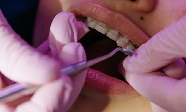 Orthodontie près d&rsquo;Epernay : Souriez en confiance avec Spark à Sillery