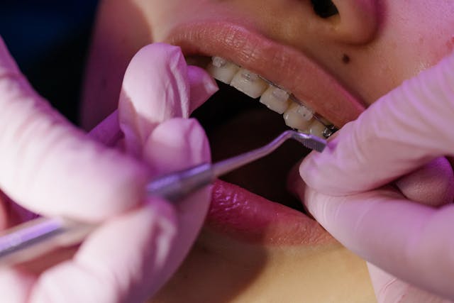 Orthodontie près d&rsquo;Epernay : Souriez en confiance avec Spark à Sillery
